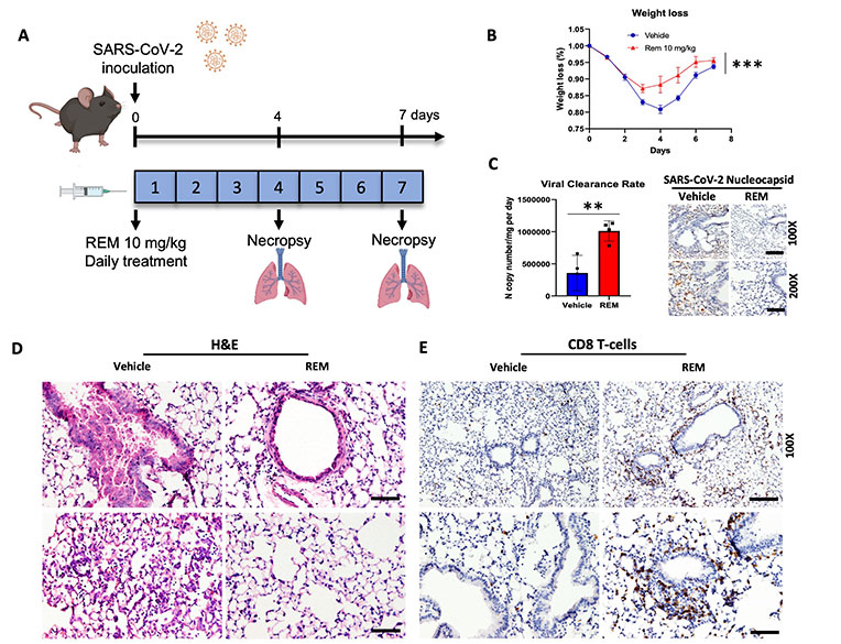 Study on REM treatment in SARS-CoV-2 infected mice: A) Treatment timeline; B) Weight loss graph; C) Viral clearance and nucleocapsid staining; D) Lung tissue H&E staining; E) CD8 T-cell staining.